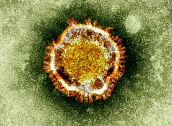 Onko tässä uusi pandemien aiheuttava Korona virus. Virus on löytynyt Lähi-Idästä ja se on tappanut useissa alueen maissa asukkaita. Virus tuhoaa keuhkot